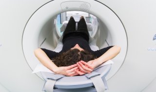Image of a PET scan
