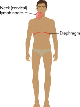 Illustration of a man with labels pointing to the neck and diaphragm