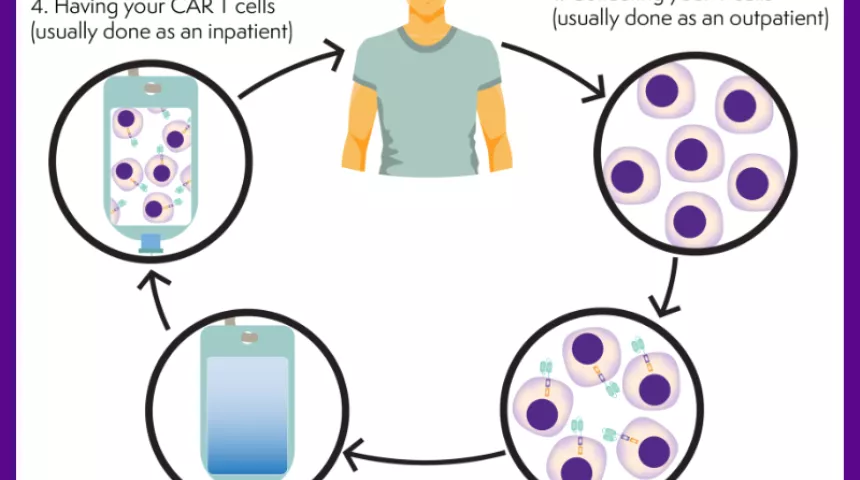 Diagram showing a patient receiving CAR T cell therapy
