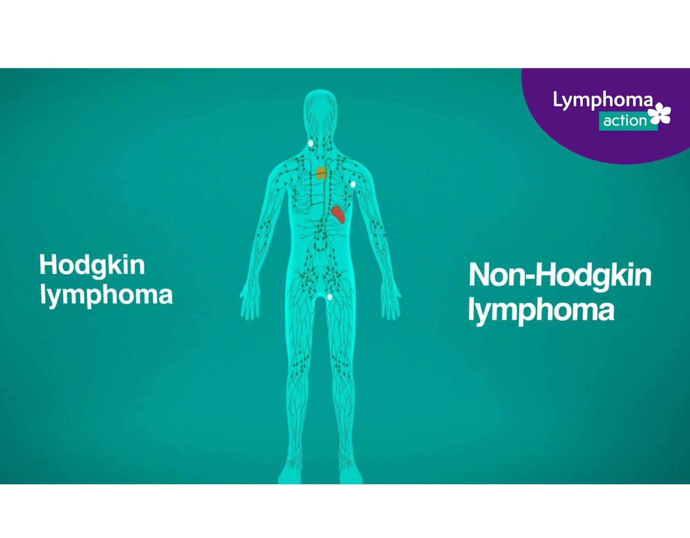 Hero Image of animation What is lymphoma