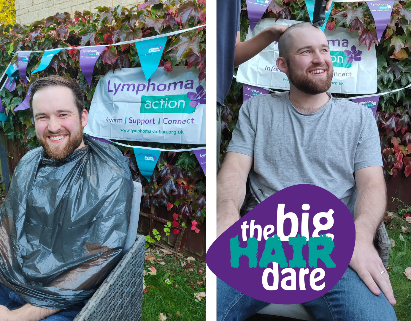 James before and after taking part in a fundraising head shave