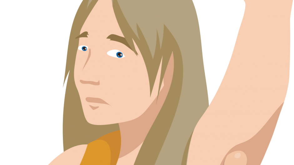 Illustration of a young white woman showing a swollen node under her armpit