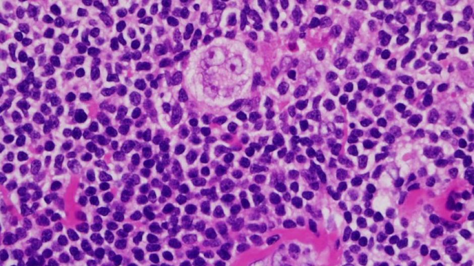 Pink and purple cells under a microscope. They are quite round and big.