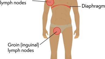 Illustration of a man with labels pointing to the neck, diaphragm, armpit, and groin