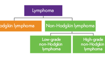 Diagram showing lymphoma can be categorised into Hodgkin lymphoma and non-Hodgkin lymphoma. Non-Hodgkin lymphoma is then further split into low-grade non-Hodgkin lymphoma and high-grade non-Hodgkin lymphoma