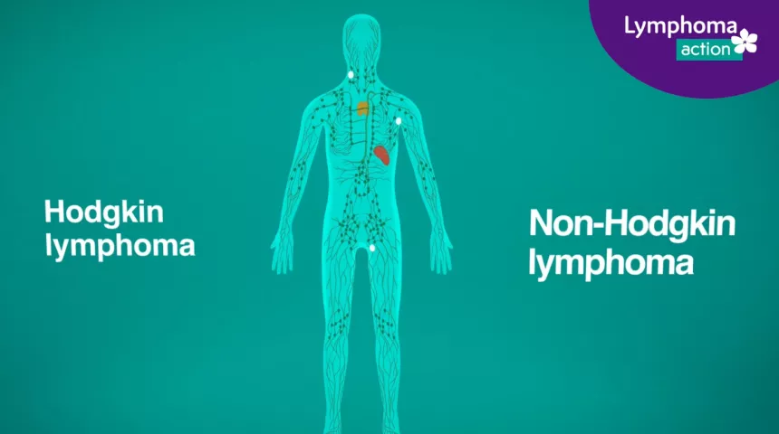 Hero Image of animation What is lymphoma