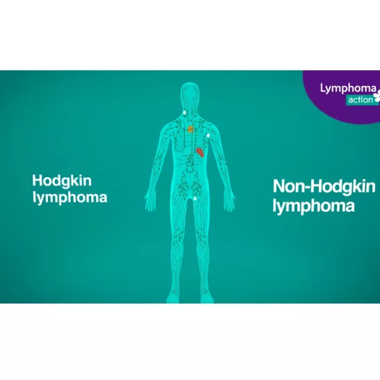 Listing image for animation What is lymphoma