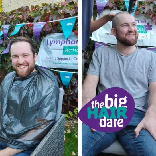 James before and after taking part in fundraising head shave