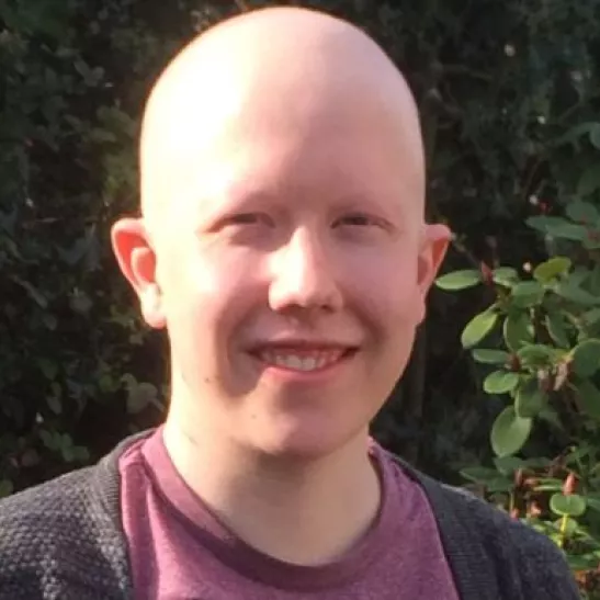 Callum, during treatment for lymphoma, aged 22