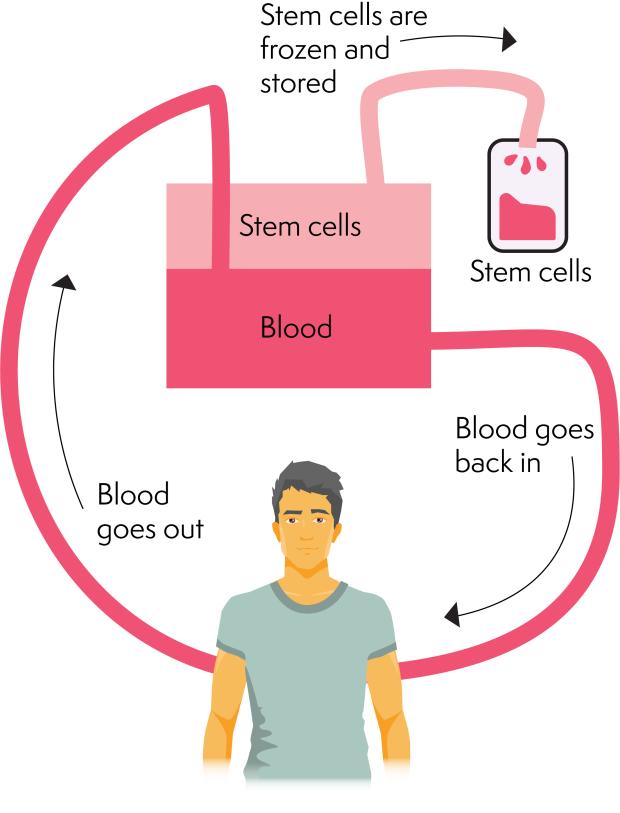 Collection of stem cells, where stem cells are separated from your blood by a machine