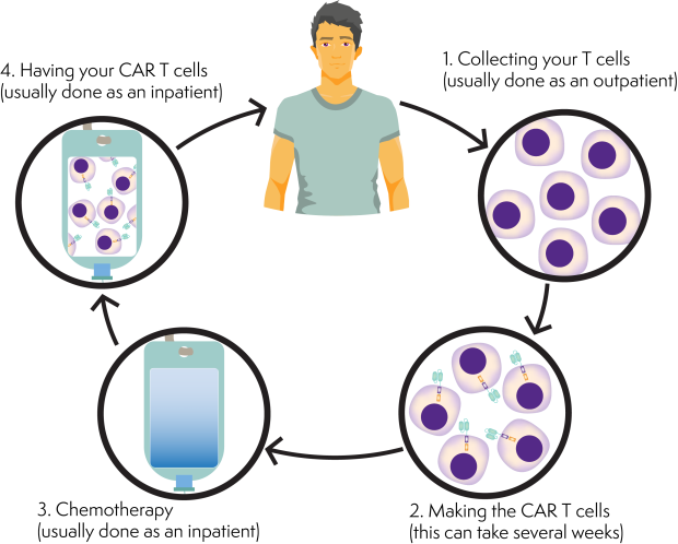 A flow chart showing the process of having CAR T-cell treatment. Starts with collecting your T cells, to making the CAR T cells, to having chemotherapy to having your CAR T cells.