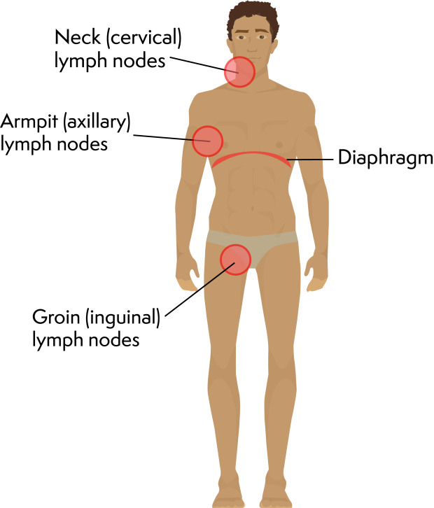 Illustration of a man with labels pointing to the neck, diaphragm, armpit, and groin