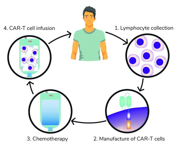 Stages of CAR-T cell therapy. Image of a man with an arrow to 1. Lymphocyte collect, with an image of lymphocyes. Arrow to 2. Manufacture of CAR-T cells with image of CAR-T cell. Arrow to 3. Chemotherapy, with image of a chemotherapy drug infusion bag. Arrow to 4. CAR-T cell infusion, with image of infusion bag containing CAR-T cells. Arrow back to man.